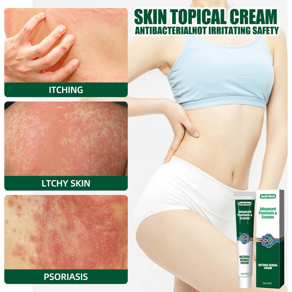 South Moon Herbal Cream for Moisturizing and Itch Relief